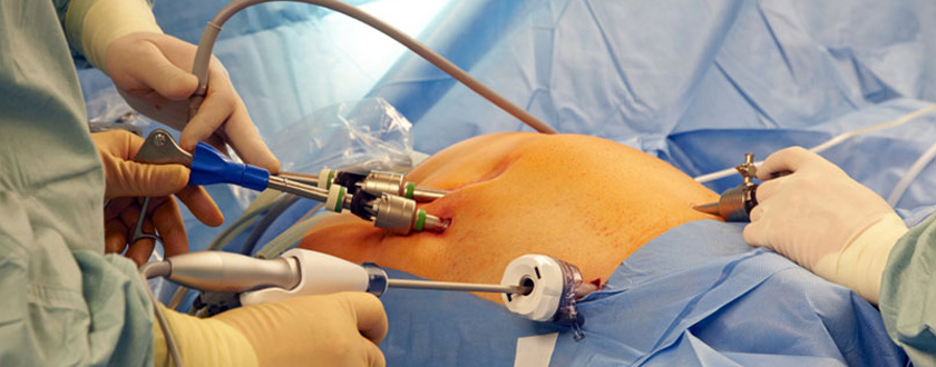 General-Laparoscopic