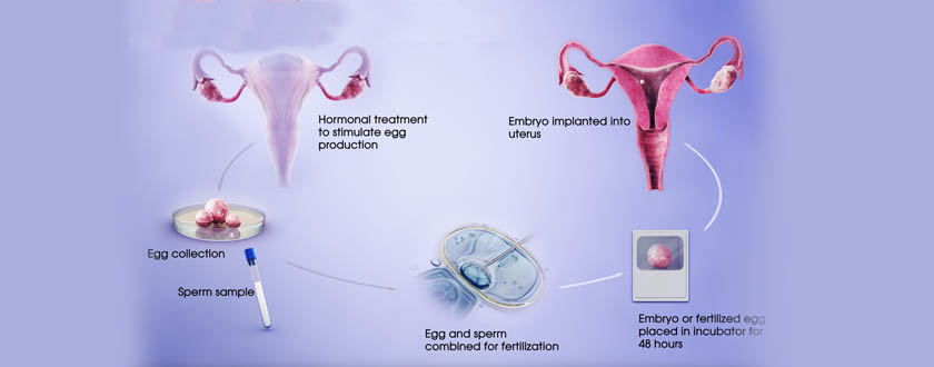in-vitro