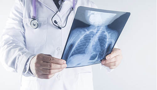 x-ray